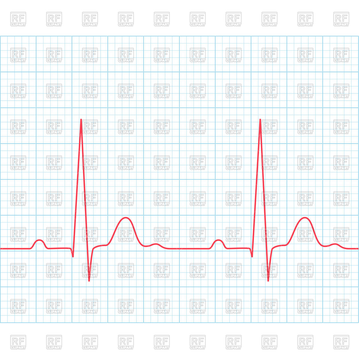 Medical Electrocardiogram 1200x1200 Medical Electrocardiogram