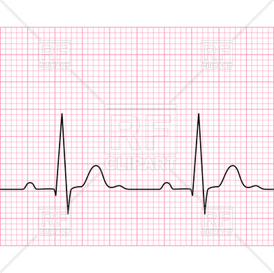 Medical Electrocardiogram 400x399 Medical Electrocardiogram