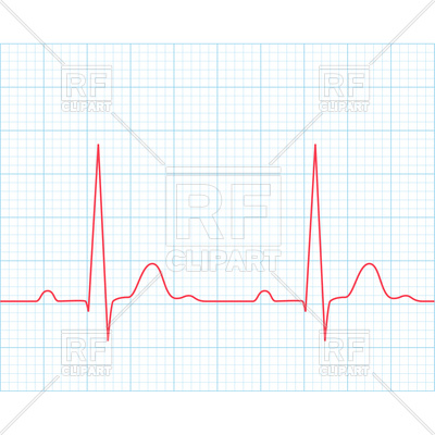 Medical Electrocardiogram 400x400 Medical Electrocardiogram