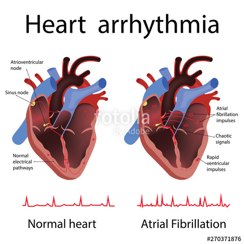 500x500 Heart Anatomy And Types Of Heart Disease Vector Illustration