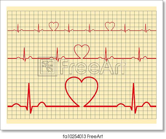 560x470 Free Art Print Of Heart Monitor Vector Freeart
