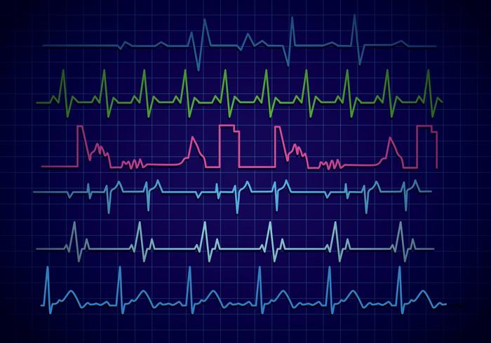 700x490 Heart Monitor Vector