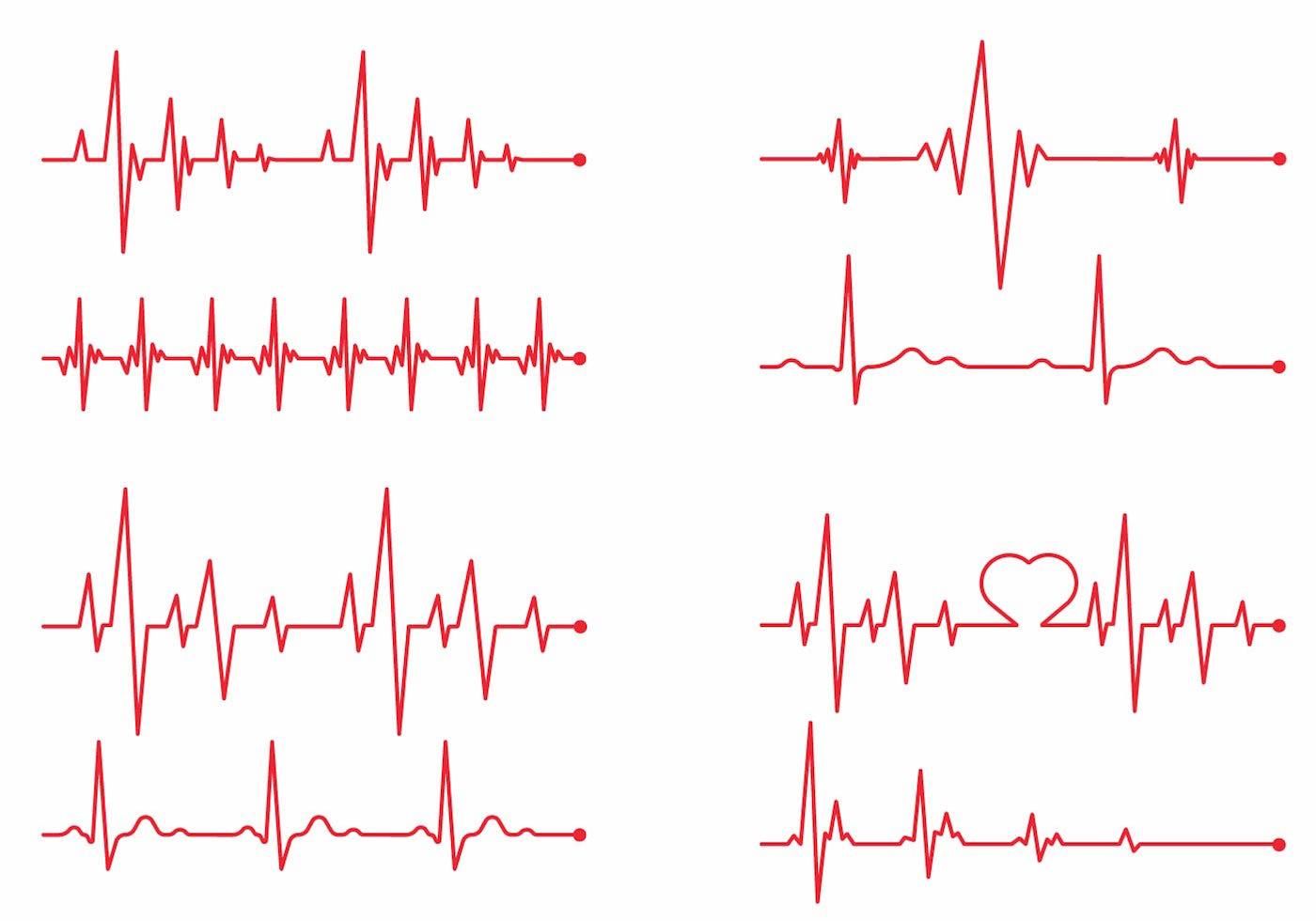 1400x980 Heart Monitor Vector Set Raznoe Pulse Tattoo, Tattoos, Ekg Tattoo