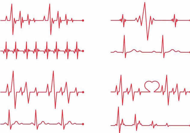 Heart Monitor Vector at Vectorified.com | Collection of Heart Monitor ...