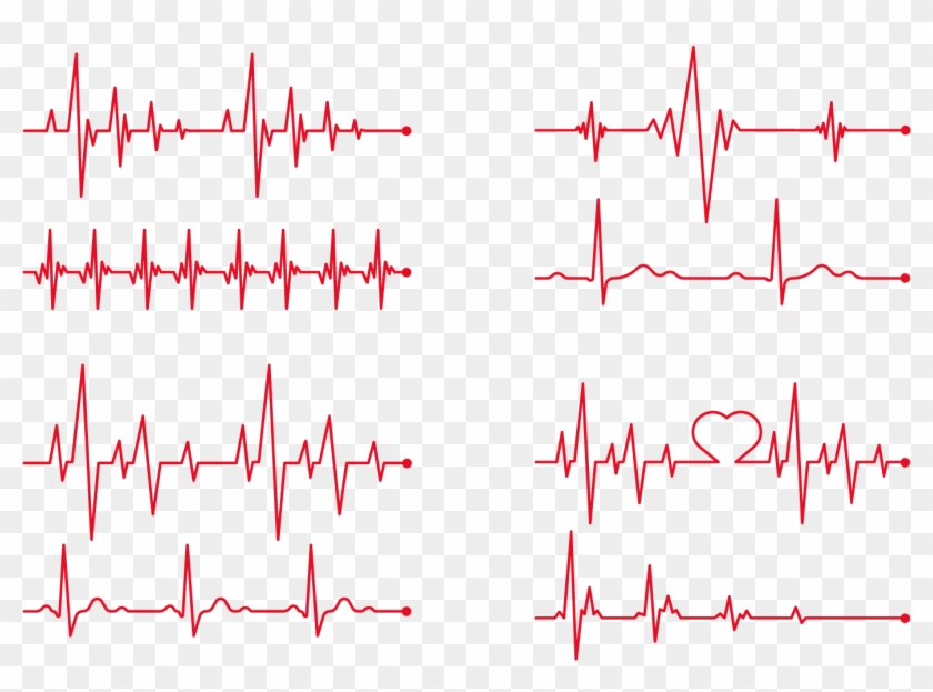 Heart Rate Electrocardiography Clip Art 840x623 Heart Rate Electrocardiography Clip Art