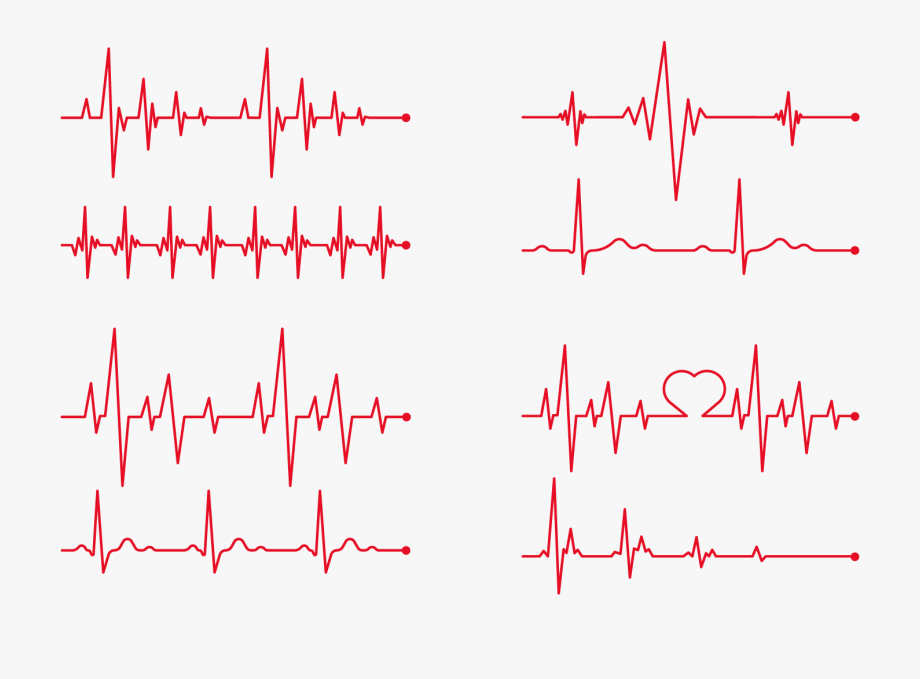 Heart Rate Electrocardiography Clip Art 920x679 Heart Rate Electrocardiography Clip Art