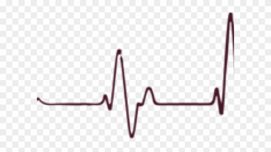 Pulse Clipart Heart Rhythm 880x494 Pulse Clipart Heart Rhythm