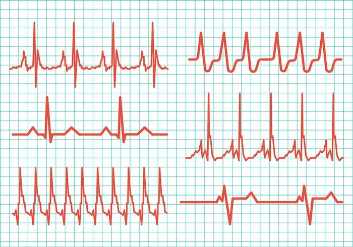 Heart Rhythm Vector Icons Free Graphics Uihere 700x490 Heart Rhythm Vector Icons Free Graphics Uihere