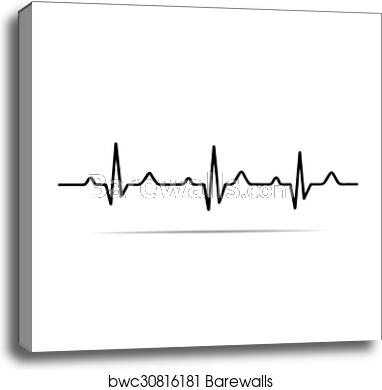 Vector Illustration Heart Rhythm Ekg, Canvas Print Barewalls 382x390 Vector Illustration Heart Rhythm Ekg, Canvas Print Barewalls