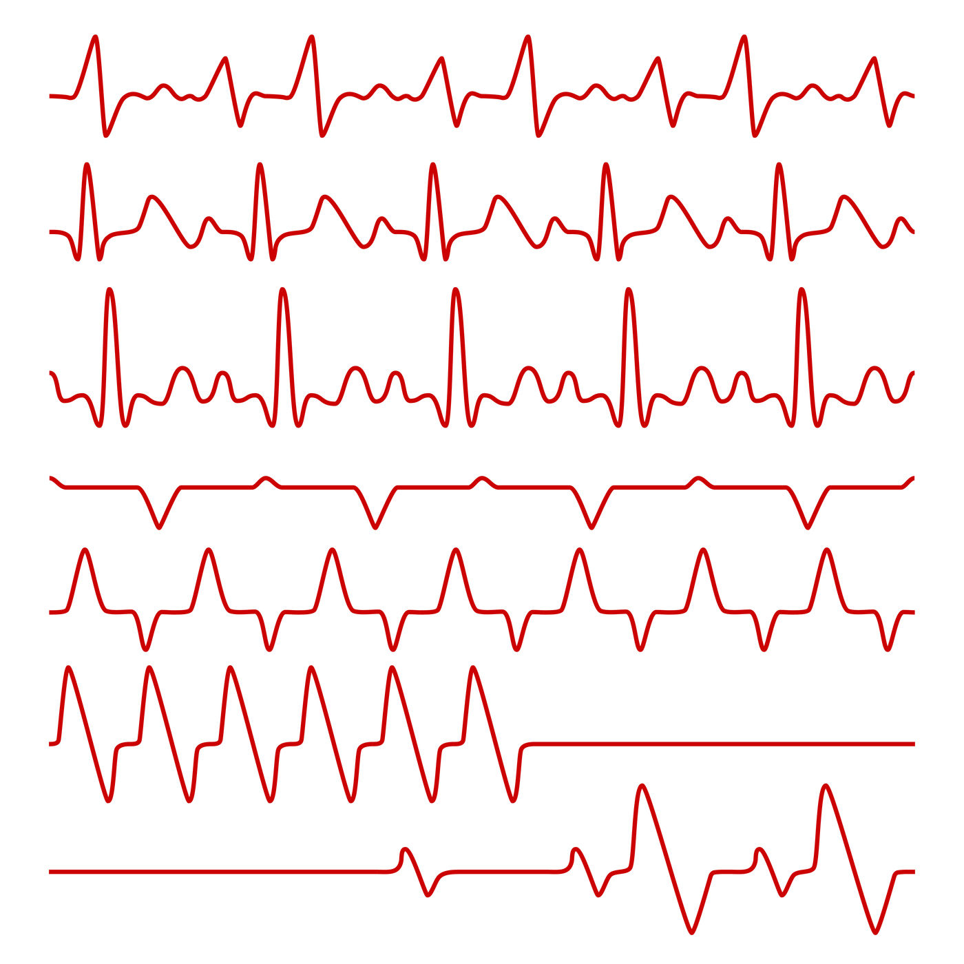 1400x1400 Line Vector Cardiograms Or Electrocardiogram On Monitor, Heartbeat