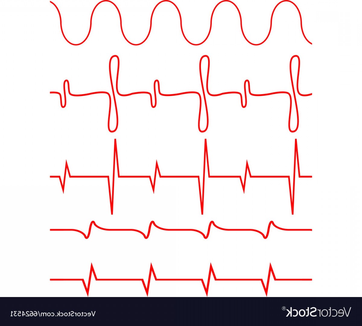 Кривая кардиограммы
