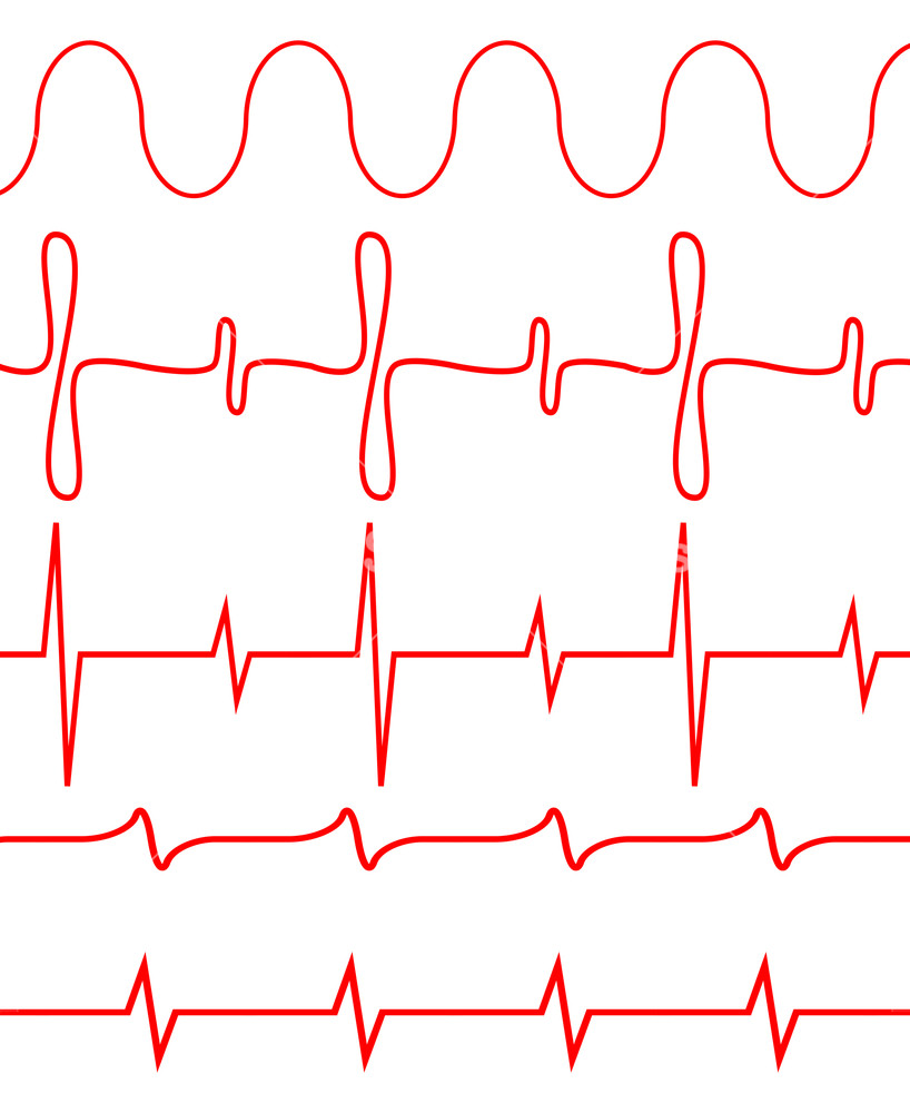 818x1000 Seamless Set Of Lines Heartbeat Pulse Electrocardiogram