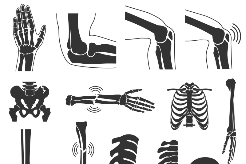 800x533 Orthopedic And Spine Vector Black Symbols Human Bones Icons