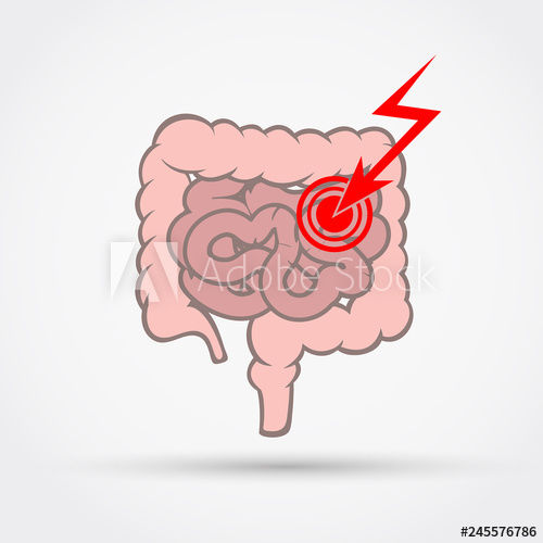 500x500 Pain In Small And Large Intestine Vector Illustration Flat Design