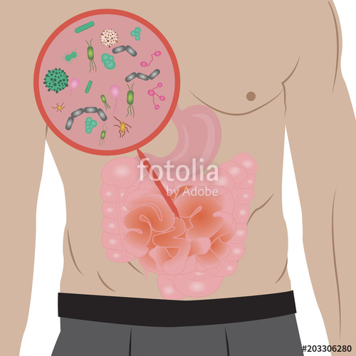 500x500 Stop Infection Overgrowth In Intestine Vector Illustration Stock