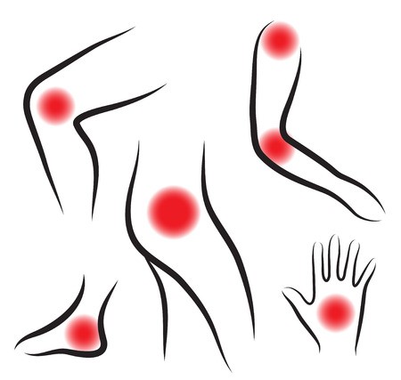 450x427 Set Of Body Joints, Joint Pain Vector Illustration Royalty Free