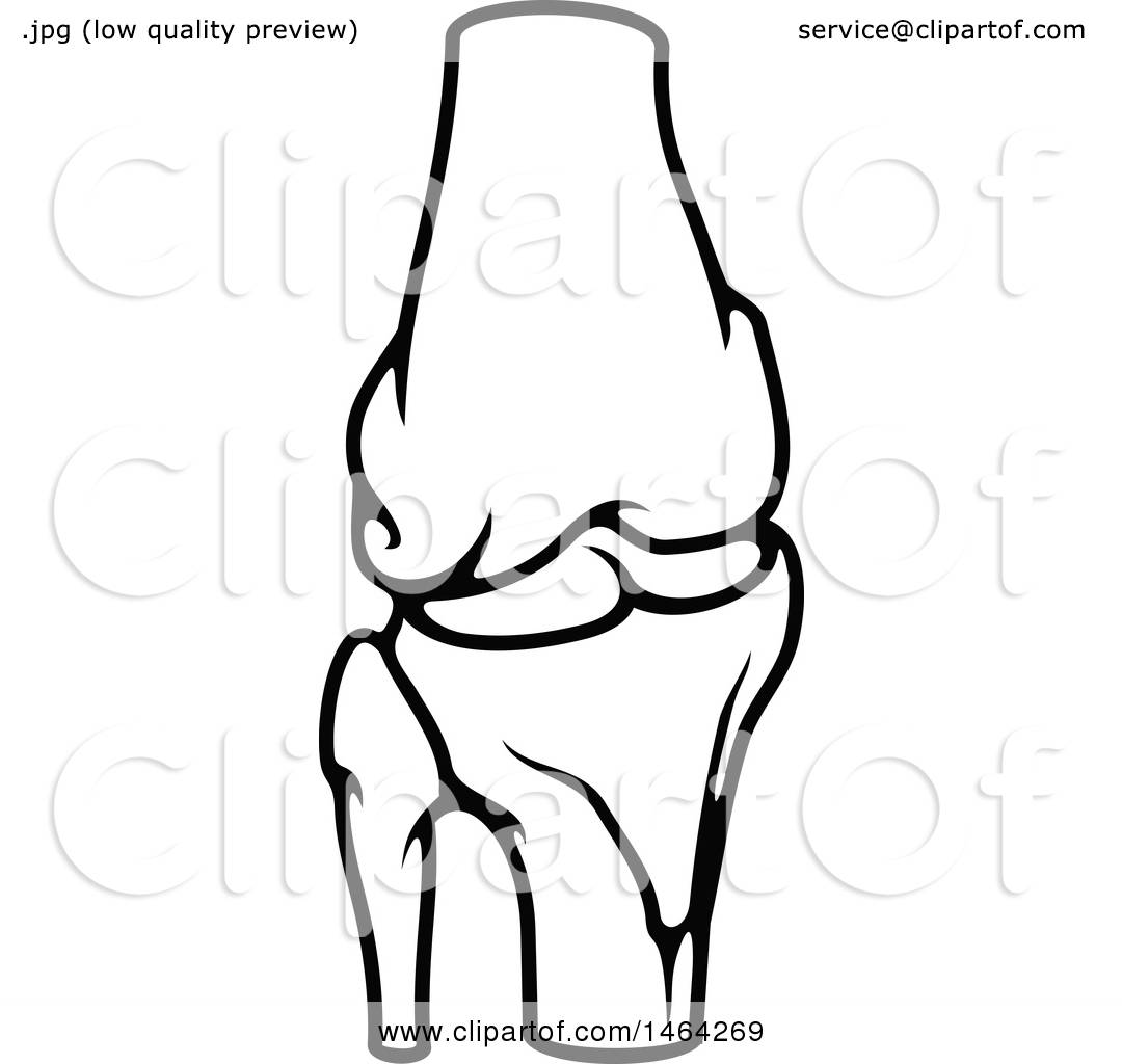 1080x1024 Clipart Of A Black And White Human Knee Joint