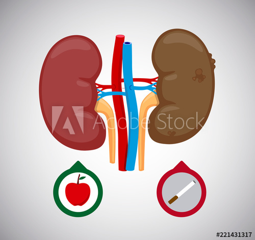 500x470 Healthy And Sick Kidney Vector Illustration Sick Human Internal