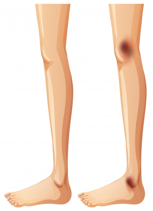 Leg Vector At Vectorified.com | Collection Of Leg Vector Free For ...