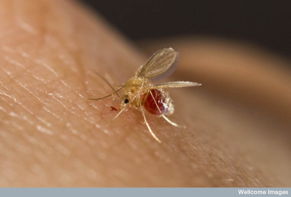 1000x679 Expedition Medicine Visceral Leishmaniasis