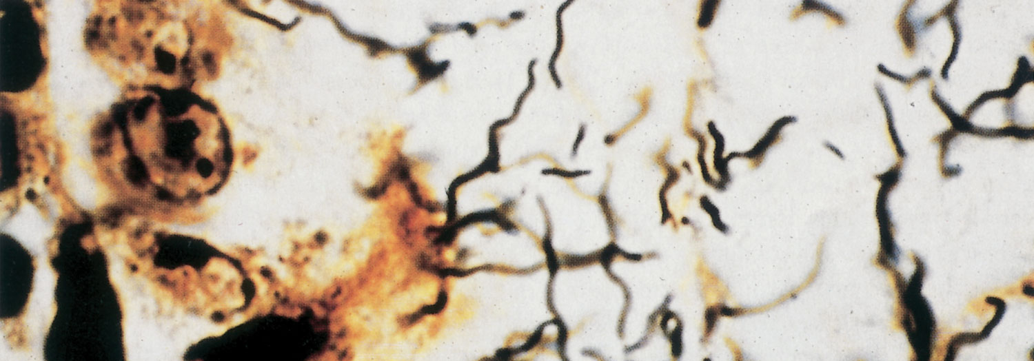 1500x524 Leptospirosis