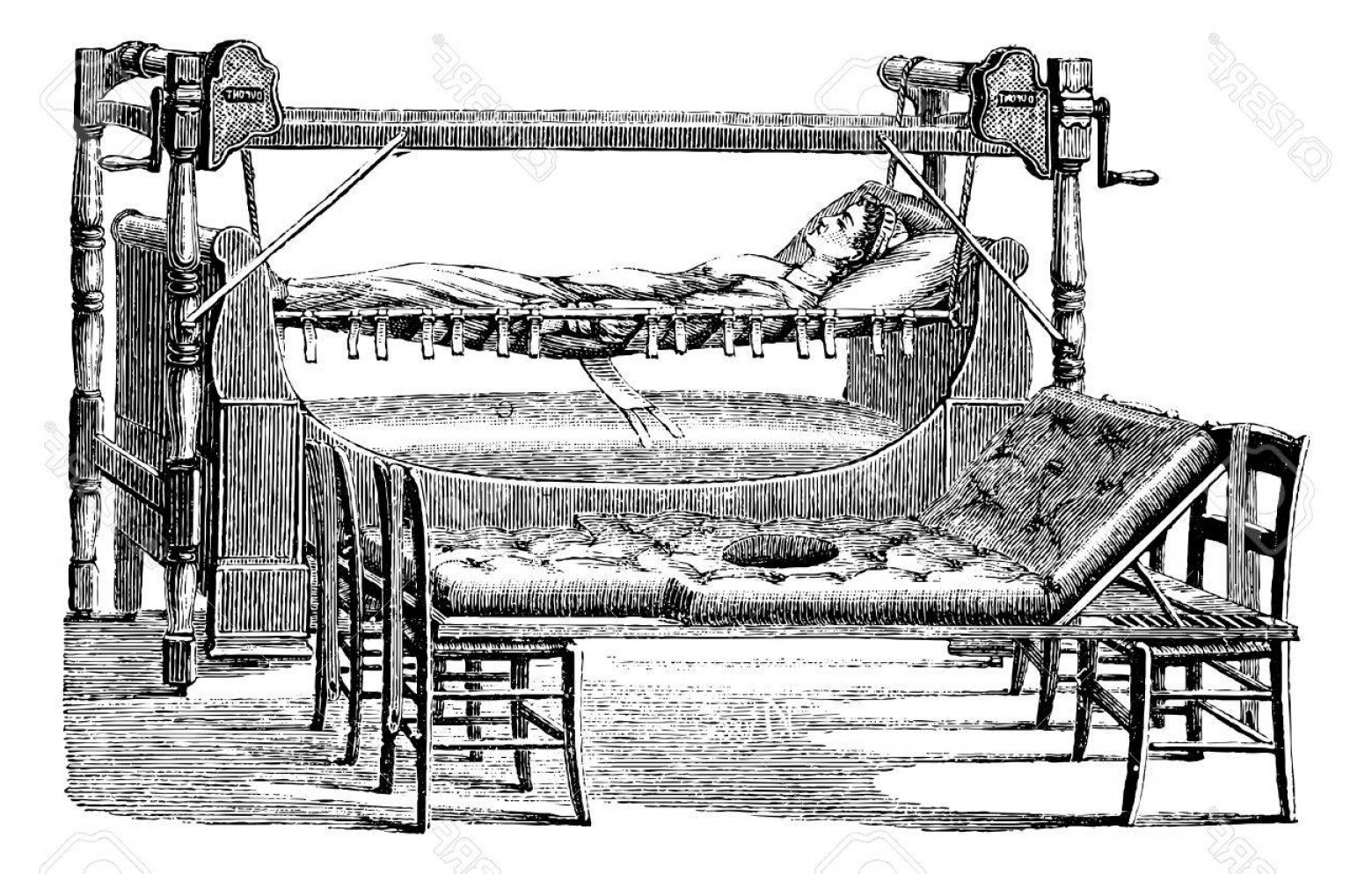 1560x994 Photostock Vector Dupont Device To Lift The Patient And Give