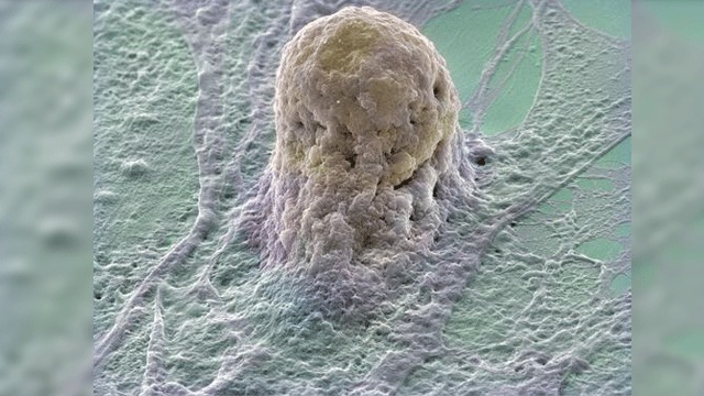 640x360 Measles Virus Vector Used To Streamline Cell Reprogramming