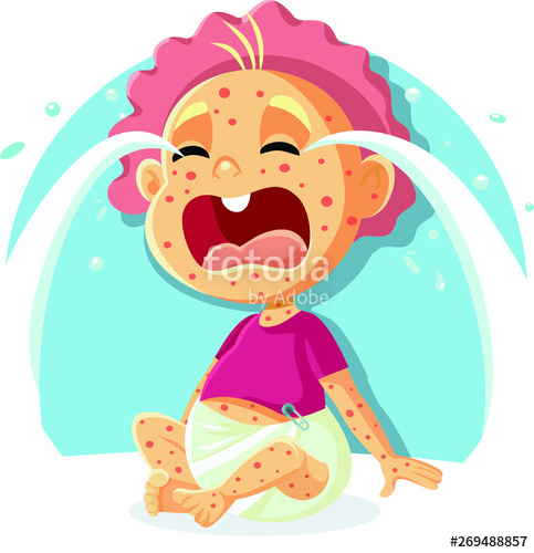 483x500 Sick Crying Baby With Measles Illustration Stock Image