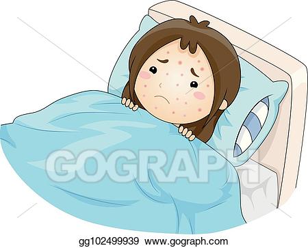 450x363 Clipart Chicken Measles For Free Download And Use Images