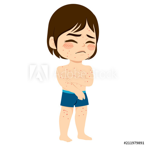 Cute Sad Little Boy With Small Itchy Blisters Symptom Ill 500x500 Cute Sad Little Boy With Small Itchy Blisters Symptom Ill
