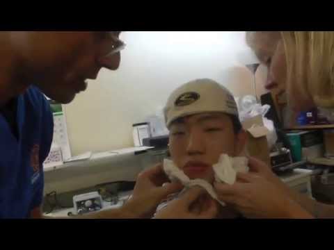 Preparation Of Adult Orthotropics Headgear 480x360 Preparation Of Adult Orthotropics Headgear