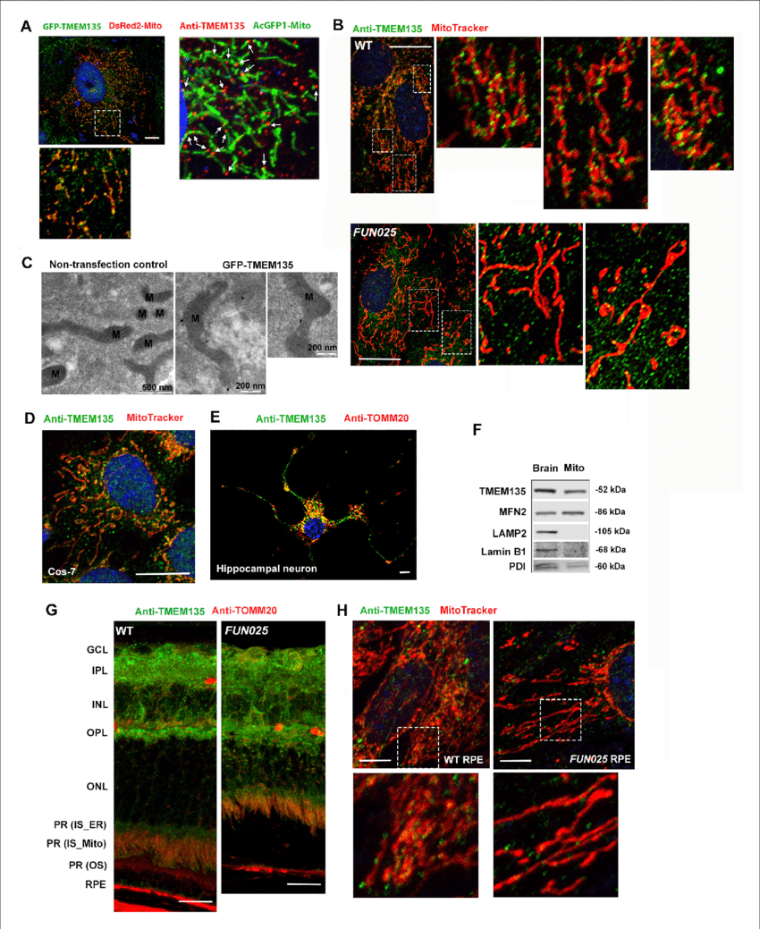 Localization Of To The Mitochondria 850x1039 Localization Of To The Mitochondria