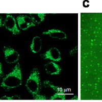 Mitotherapy For Fatty Liver 200x200 Mitotherapy For Fatty Liver