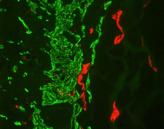 553x434 Mouse On Mouse