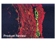 187x140 Mouse On Mouse