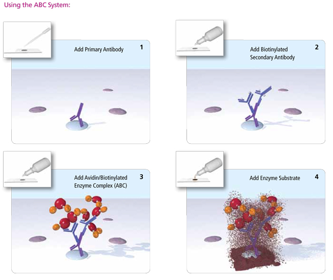 Vectastain Elite Abc Hrp Kit 650x547 Vectastain Elite Abc Hrp Kit