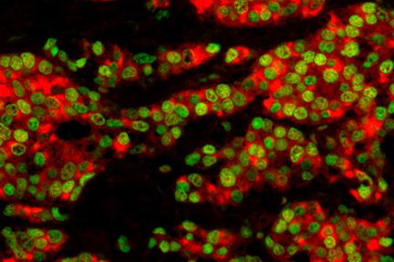 432x288 Abc Ap Staining Kit