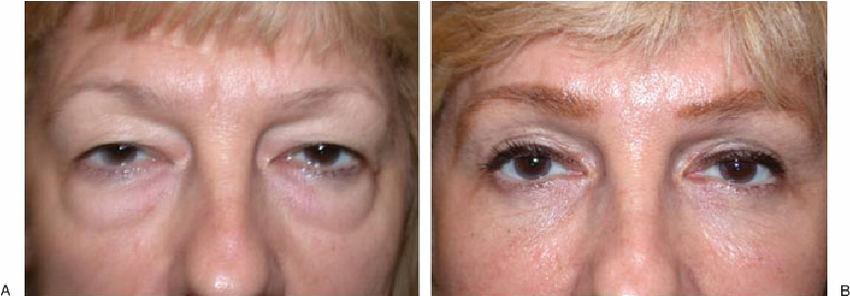 850x296 Case As Opposed To The Previously Noted Two Patients, This