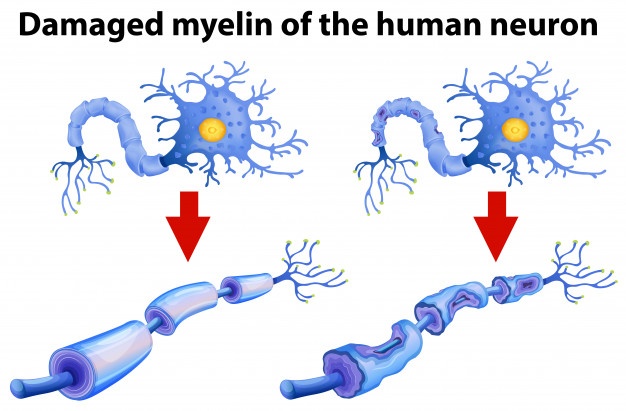 Neuron Vectors, Photos And Free Download 626x411 Neuron Vectors, Photos And Free Download