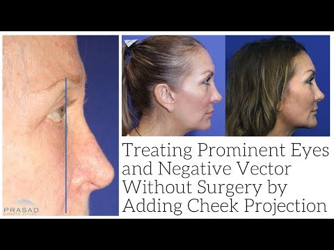 480x360 How Prominent Eyes And Negative Vector Can Be Improved Without