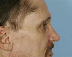 240x189 Facial Cosmetic Austin, Tx