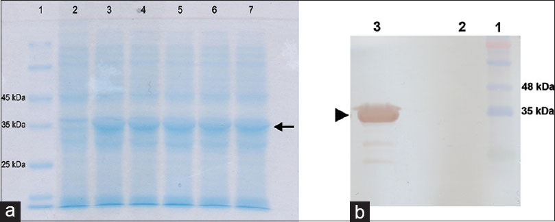 Isolation, Cloning, And Expression Of E Coli Bira Gene 809x324 Isolation, Cloning, And Expression Of E Coli Bira Gene