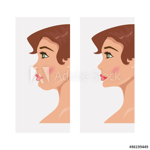 Plastic Surgery Vector