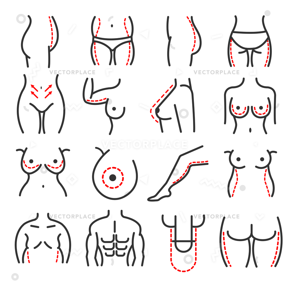 1000x1000 Plastic Body Cosmetic Surgery Line Icons Vector Illustration