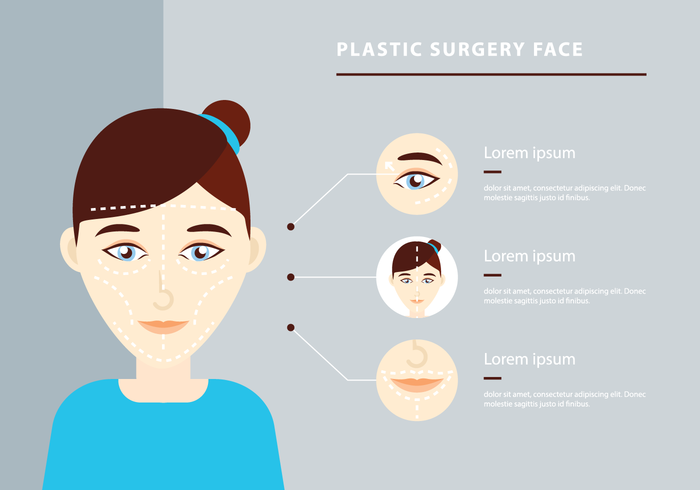 700x490 Plastic Surgery Face Infographic