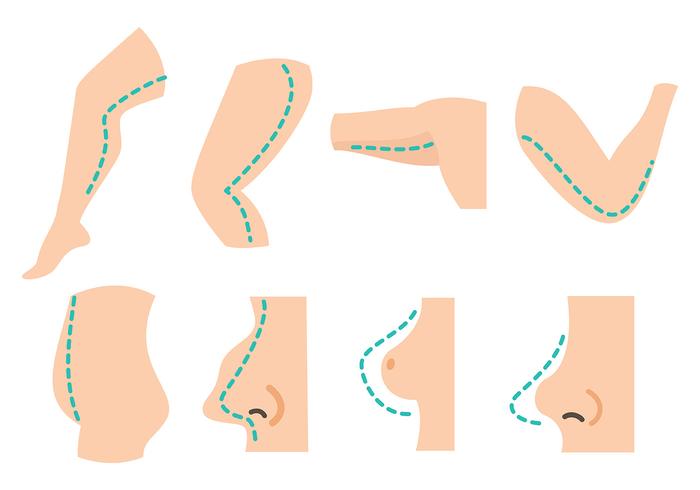 700x490 Plastic Surgery Free Vector Art