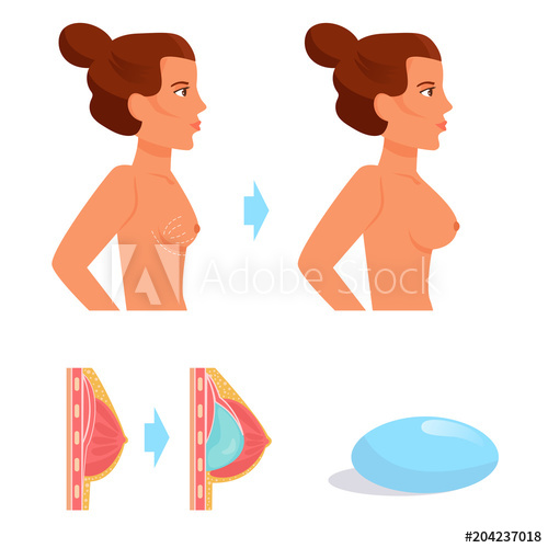 500x500 Plastic Surgery Vector Cartoon