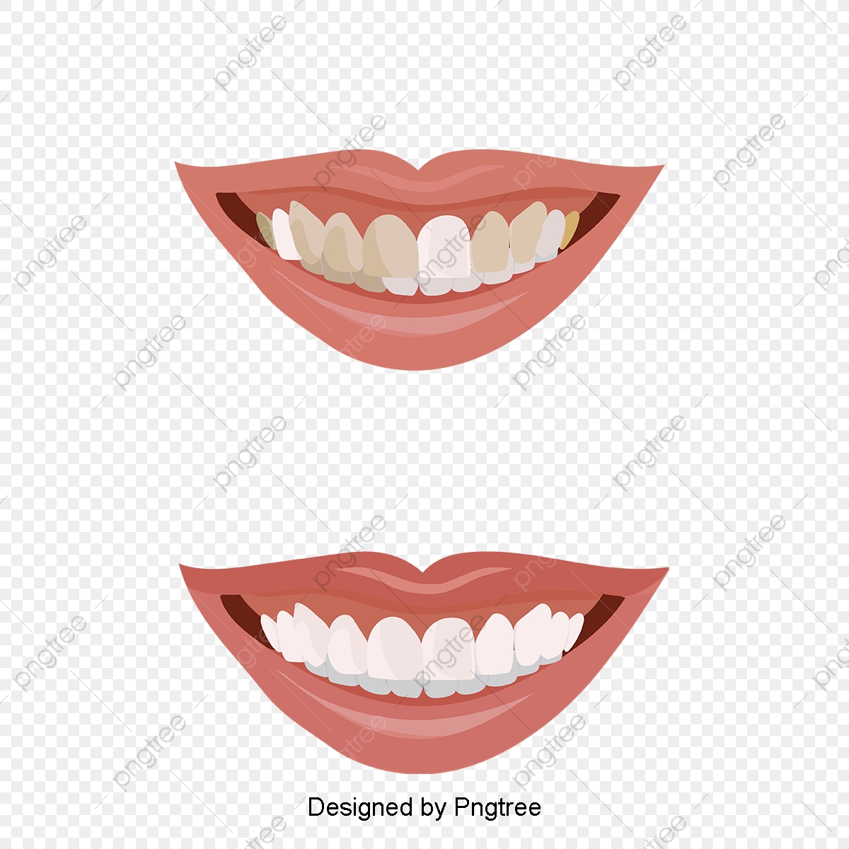1200x1200 Vector Illustration Of Character Whitening Tooth Before And After