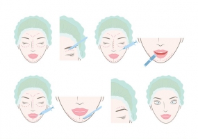 285x200 Cosmetic Surgery Free Vector Graphic Art Free Download