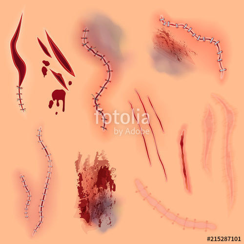 500x500 Realistic Vector Various Bloody Wounds, Surgical Stitches, Scars